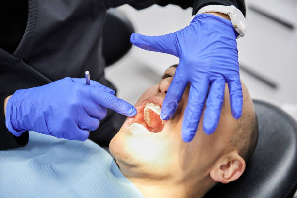 Dentist for Dental Trauma in NY